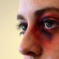 Victim of Domestic Abuse